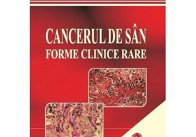 Cancerul de san. Forme clinice rare