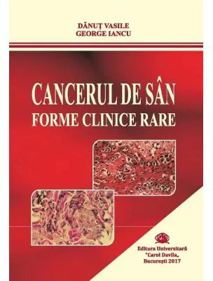 Cancerul de san. Forme clinice rare