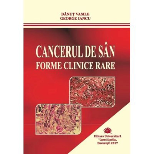 Cancerul de san. Forme clinice rare