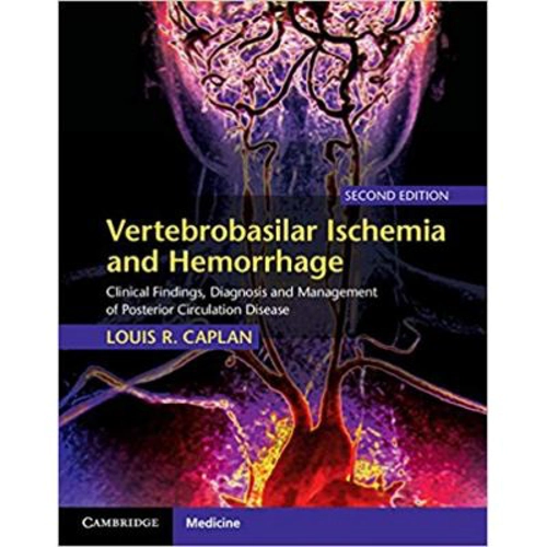 Vertebrobasilar Ischemia and Hemorrhage: Clinical Findings, Diagnosis and Management of Posterior Circulation Disease - Louis R. Caplan