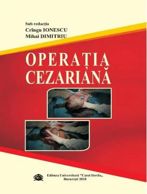 Operatia cezariana - Cringu Ionescu, Mihai Dimitriu