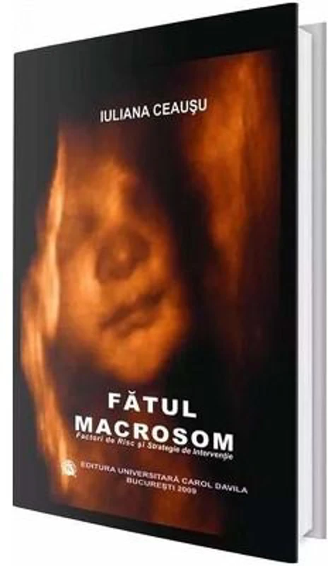 Fatul macrosom. Factori de risc si strategie de interventie