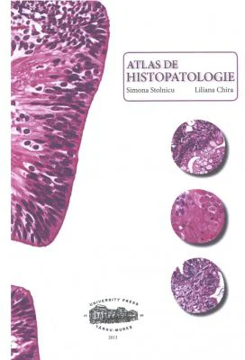 Atlas de histopatologie - Simona Stolnicu, Liliana Chira