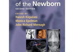 Imaging of the Newborn - Haresh Kirpalani, Monica Epelman, John Richard Mernagh