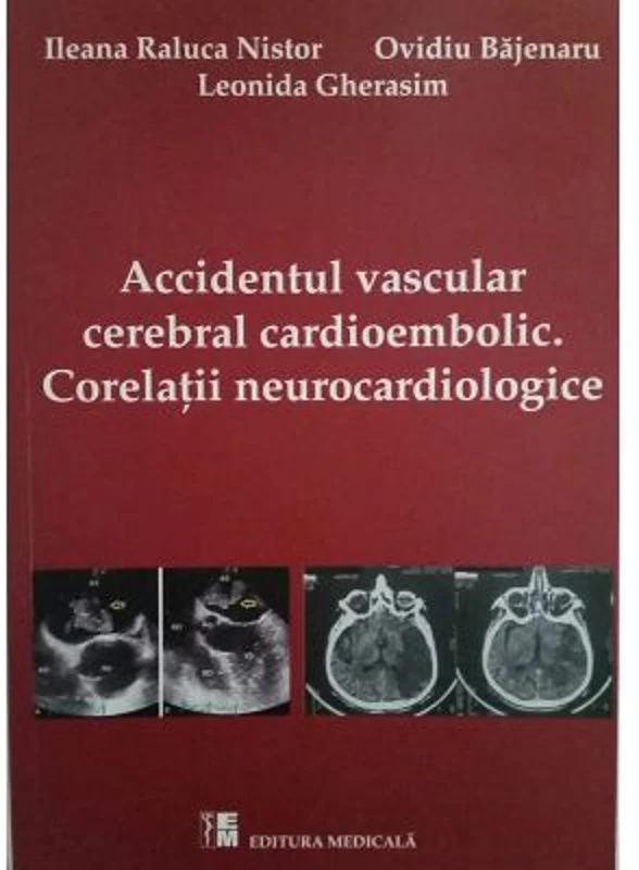 Accidentul vascular cerebral cardioembolic. Corelatii neurocardiologice