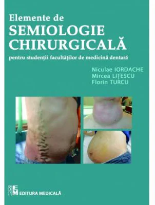 Elemente de semiologie chirurgicala pentru studentii facultatilor de medicina dentara - Mircea Litescu