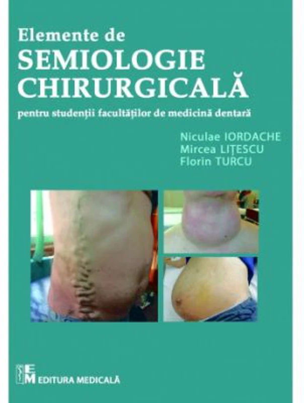 Elemente de semiologie chirurgicala pentru studentii facultatilor de medicina dentara - Mircea Litescu