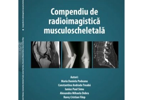 Compendiu de radioimagistica musculoscheletala - Maria Daniela Podeanu