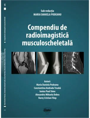 Compendiu de radioimagistica musculoscheletala - Maria Daniela Podeanu