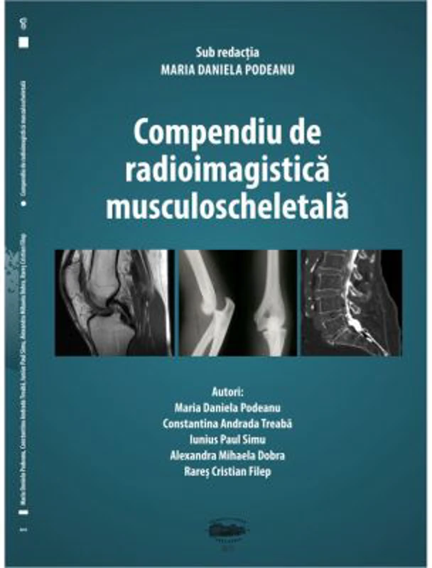 Compendiu de radioimagistica musculoscheletala - Maria Daniela Podeanu