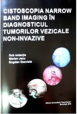Cistoscopia narrow band imaging in diagnosticul tumorilor vezicale non-invazive - Marian Jecu, Bogdan Geavlete