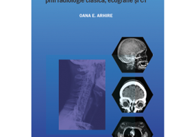 Radiologie musculo-scheletica, diagnostic complex prin radiologie clasica, ecografie si CT - Elena Oana Arhire