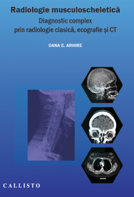 Radiologie musculo-scheletica, diagnostic complex prin radiologie clasica, ecografie si CT - Elena Oana Arhire