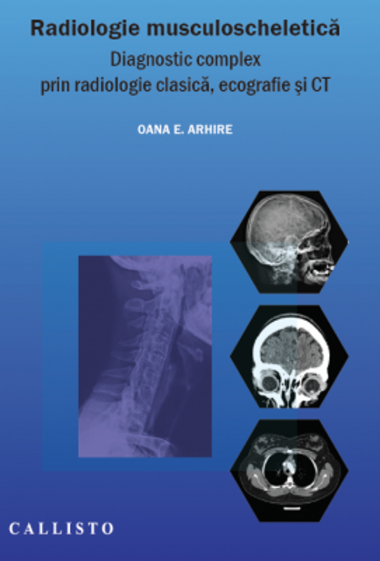 Radiologie musculo-scheletica, diagnostic complex prin radiologie clasica, ecografie si CT - Elena Oana Arhire