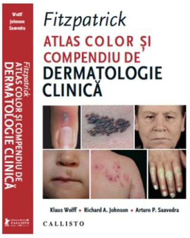 Fitzpatrick, Atlas Color si Compendiu de Dermatologie Clinica - Klaus Wolff