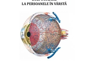 Boli oculare la persoane in varsta - Marieta Dumitrache