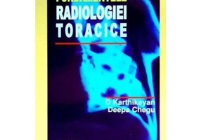 Fundamentele Radiologiei Toracice - D. Karthikeyan, D. Chegu