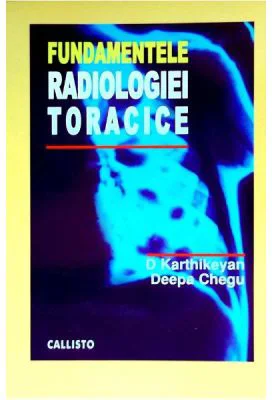 Fundamentele Radiologiei Toracice - D. Karthikeyan, D. Chegu