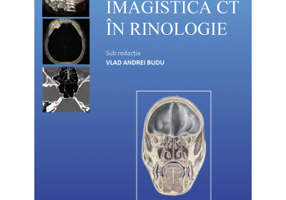 Imagistica CT in rinologie - Vlad Andrei Budu