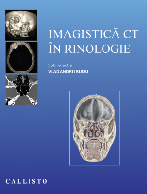 Imagistica CT in rinologie - Vlad Andrei Budu