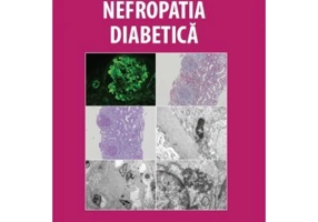 Nefropatia Diabetica - Gabriela Lupusoru, Mircea Lupusoru, Gener Ismail