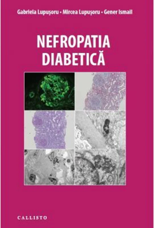 Nefropatia Diabetica - Gabriela Lupusoru, Mircea Lupusoru, Gener Ismail