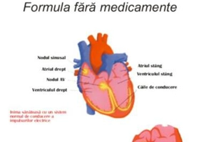 Cum să tratăm angina - Paperback brosat - Tom Rob  Smith - Antet Revolution