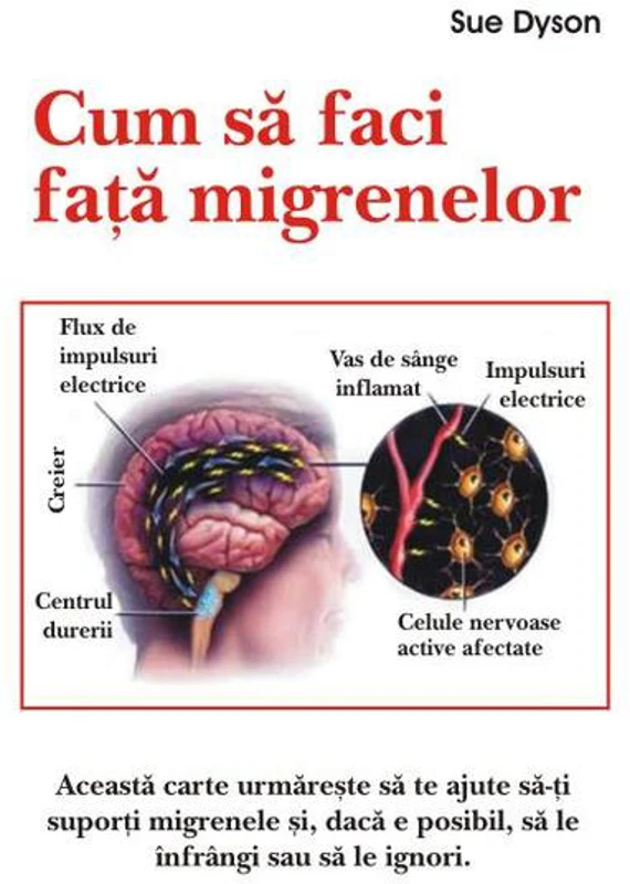 Cum să faci faţă migrenelor - Paperback brosat - Sue Dyson - Antet Revolution