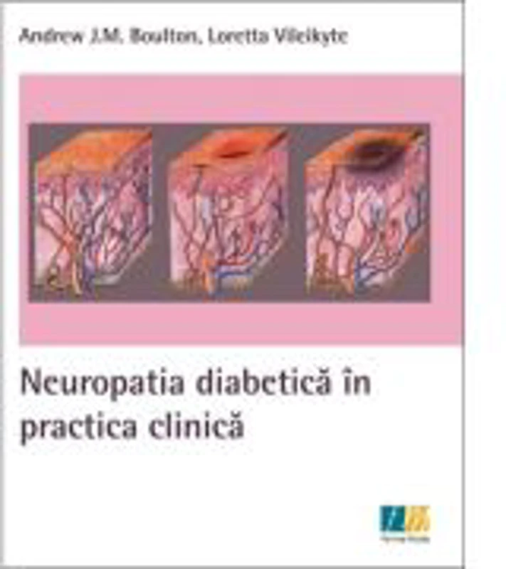 Neuropatia diabetica in practica clinica - Andrew Boulton