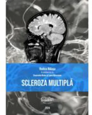 Scleroza multipla (print color) - Rodica Balasa