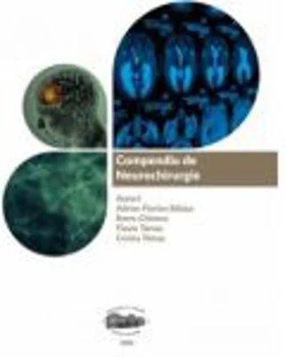 Compendiu de neurochirurgie - Adrian Balasa