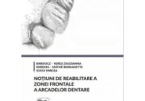 Notiuni de reabilitare a zonei frontale a arcadelor dentare - Bardocz-Veres Zsuzsanna