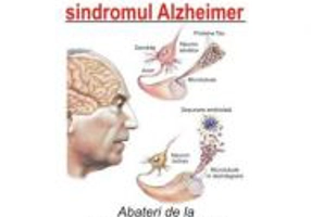 A trai cu sindromul Alzheimer - Tom Smith
