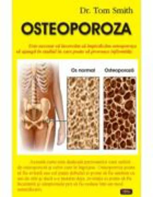 Osteoporoza - Dr. Tom Smith