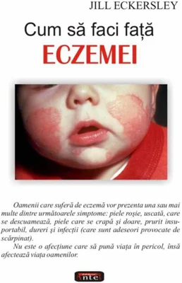 Cum să faci faţă eczemei