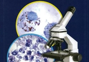 Microbii. Dușmani de moarte și aliați de nelipsit ai omului