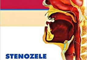 Stenozele cicatriciale laringo-traheale