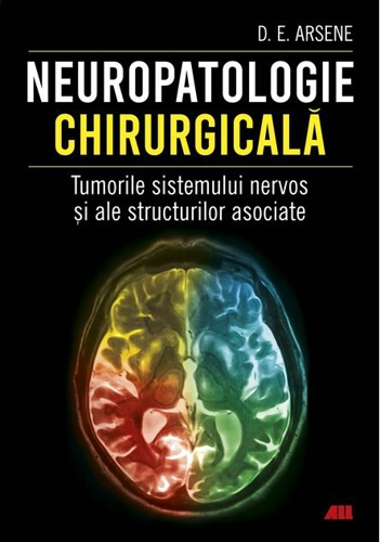 Neuropatologie chirurgicală. Tumorile sistemului nervos și ale structurilor asociate