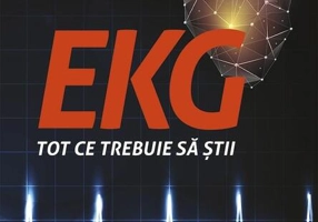 EKG - Tot ce trebuie să știi