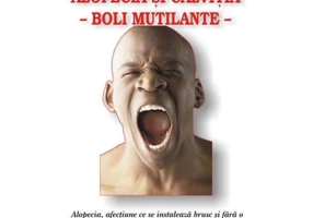 Alopecia şi calviţia